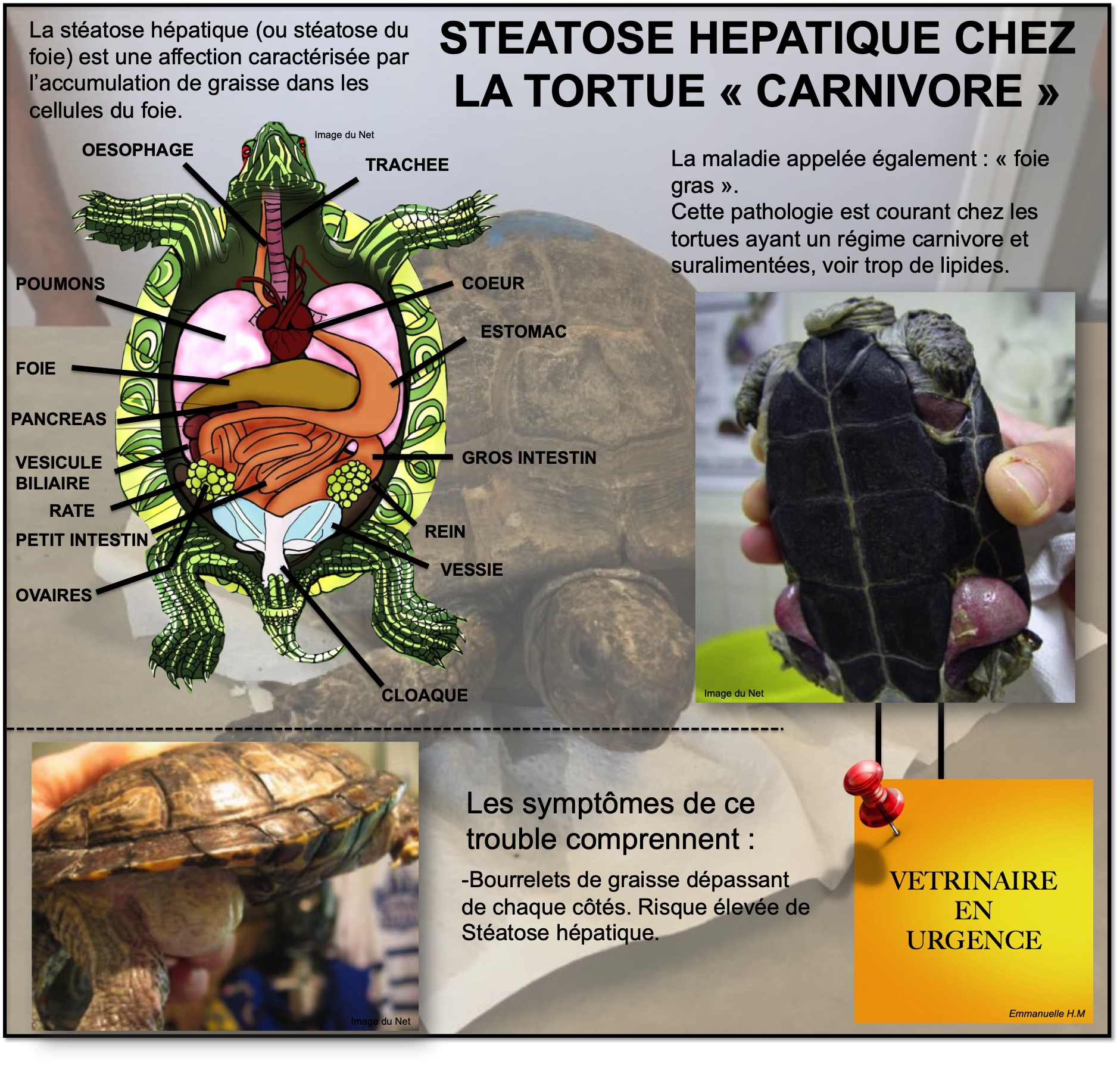Steatose hepatique