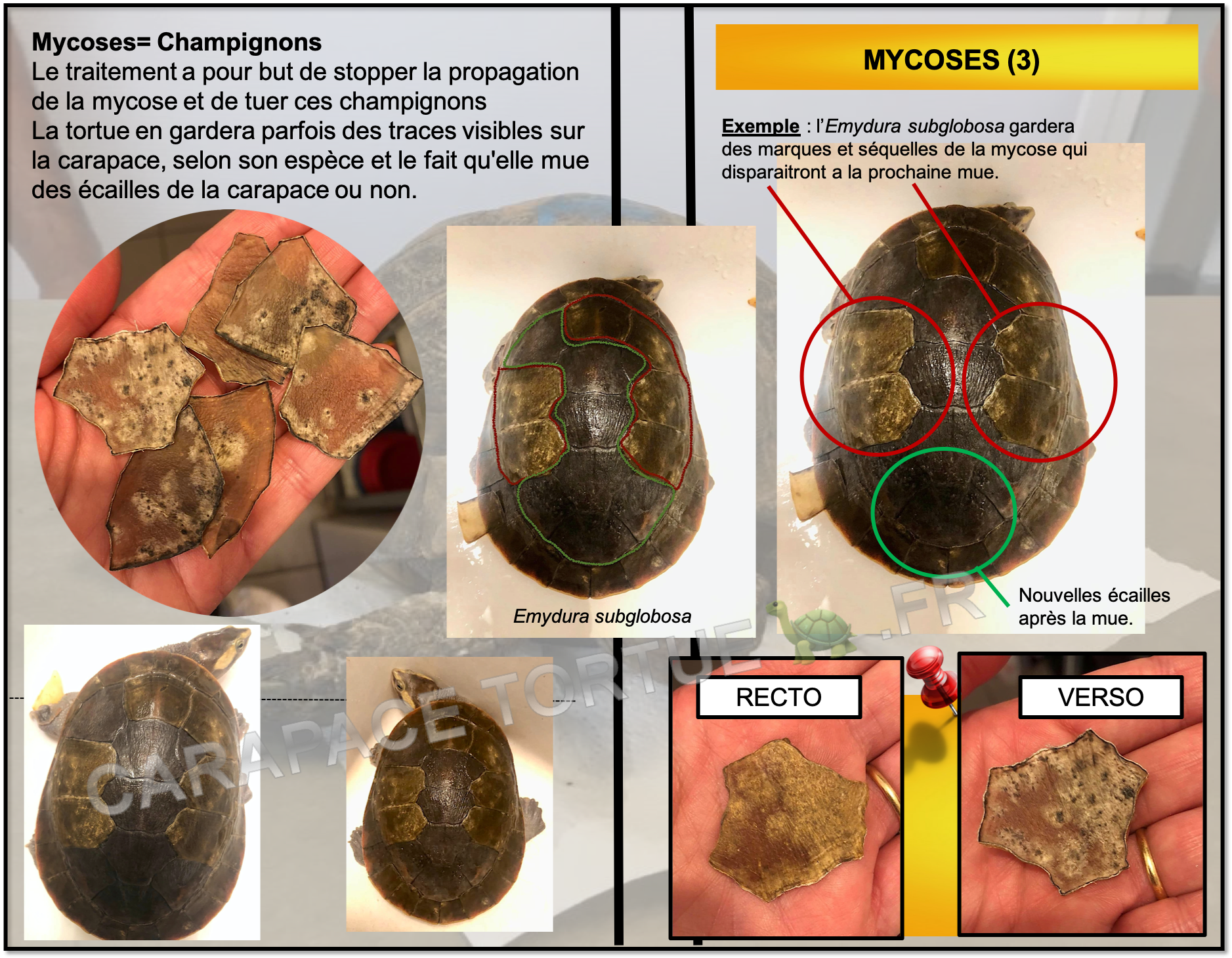 Mycoses 4