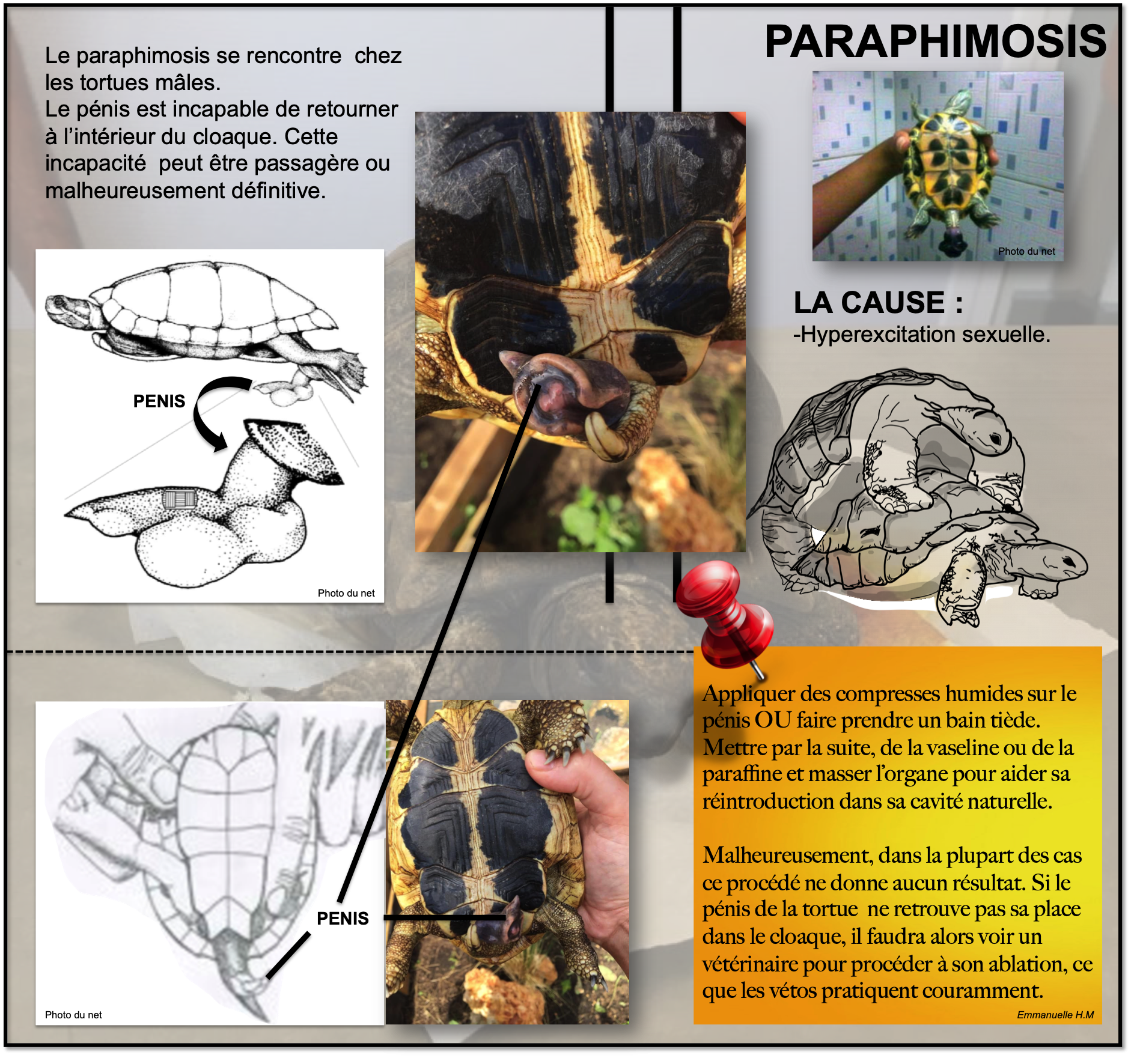 Paraphimosis